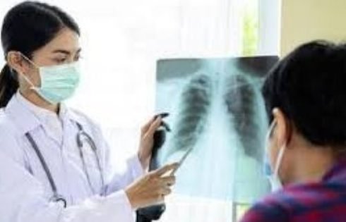 Kasus TBC Meningkat, Dinkes Sukabumi Soroti Rendahnya Keberhasilan Pengobatan