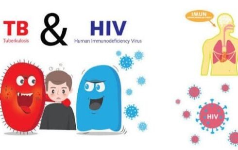 Kemenkes: Layanan Kesehatan Inklusif Jadi Kunci Penanganan TB dan HIV pada Kelompok Rentan