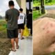 Linda Lusiyana Dungau Mengaku Dipukul di Bandara Long Ampung, Saat Hendak Terbang ke Samarinda